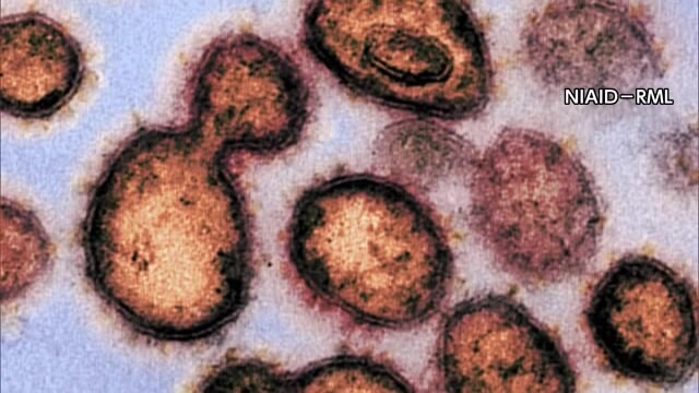 新型コロナウイルス　香川県で１人が感染　香川県内の感染者はこれで７７８人【香川】